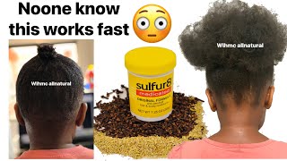 Mix Sulphur 8  Cloves amp Rosemary for Massive Hair Growth Sulphur 8 Hair growth mixture  It works [upl. by Morna]