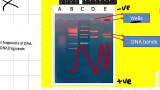 Agarose gel electrophoresis and DNA fingerprinting  Practical [upl. by Pelligrini185]