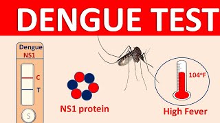 Dengue  Symptoms transmission and diagnosis [upl. by Rabkin]