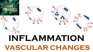 INFLAMMATION Part 1 General concepts types  Vascular changes in Acute inflammation [upl. by Mcmaster]