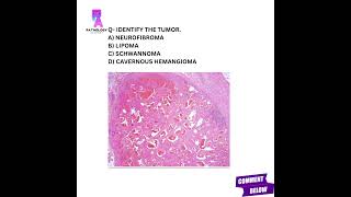 Histopathology questions histopathology mbbs md pathologyacademy draditikumar [upl. by Aiciruam227]