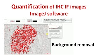 Quantification of Immunohistochemistry images using ImageJ  How to remove background in ImageJ [upl. by Haneekas]