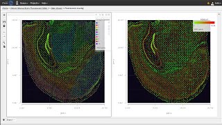 How to Analyze 10x Visium Spatial Gene Expression Data [upl. by Frisse]