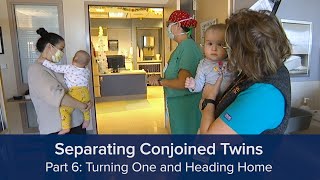 Separating Conjoined Twins Part 6 Turning One and Heading Home [upl. by Stevana]