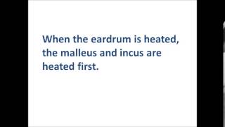 Caloric test Mechanism of Caloric Nystagmus [upl. by Fenelia277]