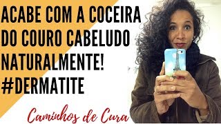 Tratamento para cabelo couro cabeludo e rosto com desconto [upl. by Evyn]