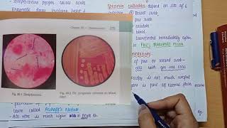 Streptococcus Pyogenes  Morphology  Virulence factors  culture amp lab diagnosis  MICROBIOLOGY [upl. by Chitkara188]