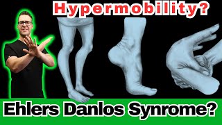 Ehlers Danlos Syndrome Hypermobility Symptoms Diagnosis amp Test [upl. by Fitts]