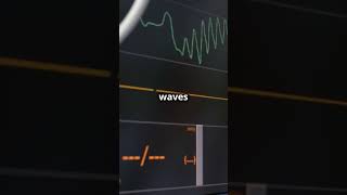 Hyperkalemia ECG Changes and Emergency Treatment medicaleducation medicalstudent DiagnosticLens [upl. by Erusaert]