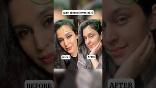 Why I stopped using Rosemary Oil hairgrowth haircaretips hairfallcontrol [upl. by Vonni]