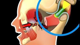 Besonderheiten des Kiefergelenks [upl. by Sally]