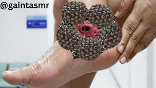 ASMR Animation Trypophobia Big size treatments knee  ASMR animation treatments ‪ [upl. by Anerdna]