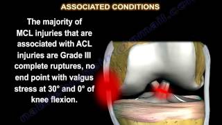 Medial Collateral Ligament injury  MCL Injuries  Everything You Need To Know  Dr Nabil Ebraheim [upl. by Refennej]