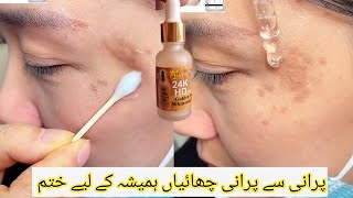 World Best Serum and Cream😱  freckle Wrinkles Remove [upl. by Sindee]