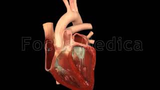 Paroxysmal atrial fibrillation  Animated Atlas of Atrial Fibrillation [upl. by Hayikat]