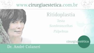 Lifting Facial  Cirurgia Plástica da Face Como é Dr Andre Colaneri explica [upl. by Noda]