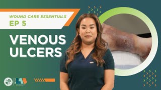 Wound Care Essentials Video 5 – Venous Ulcers [upl. by Kenny93]