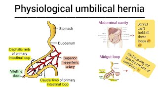 Physiological umbilical hernia embryology [upl. by Otrebliw]