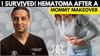 I Got a Mommy Makeover amp This Is What Happened HEMATOMA Complication [upl. by Avek996]