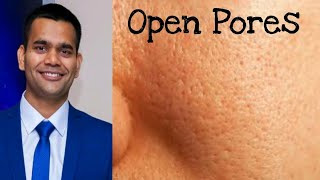 How To Get Rid Of Open Pores Permanently  open pores on face Treatment [upl. by Stoeber150]