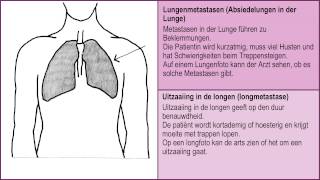 Wenn man nicht mehr gesund wird  Metastasen in Knochen Lunge Leber und Gehirn 26 [upl. by Azmah]