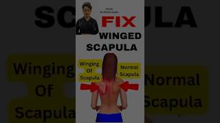 Fix WINGED SCAPULA physiotherapy shoulderpainrelief scapularpain scapula strengthtraining [upl. by Nnagem98]