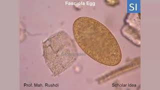 Fasciola egg [upl. by Oahc590]