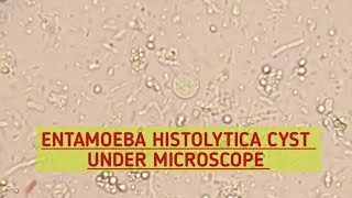 Entamoeba Histolytica EHcyst under microscopeStool MicroscopyStool Parasites under microscope [upl. by Tacye]