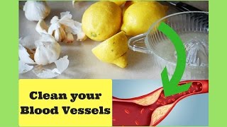 Homemade Therapy to Clean your Blood Vessels in Just 40 Days [upl. by Ardnama]