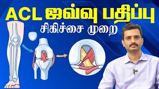 ACL ஜவ்வு பாதிப்பு ACL Ligament tear injury amp Treatmeny in Tamil  Dr Balaji Atlas Hospital Trichy [upl. by Ynneg]