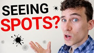 Eye Floaters  7 Reasons You See Spots in Your Vision [upl. by Annaer240]