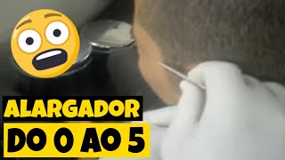 Alargador Furando Orelha  De 0 a 5mm em Segundos [upl. by Amoihc]