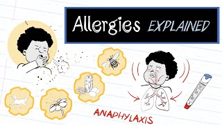 What are Allergies HealthSketch [upl. by Ahsilam]