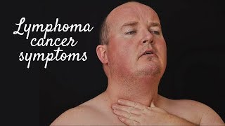 LYMPHOMA CANCER SYMPTOMS [upl. by Greenburg]