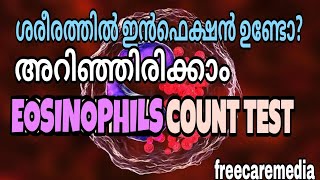 Eosinophils count test malayalam  allergy test  skin disease [upl. by Ynaittirb]