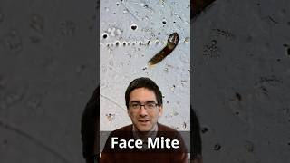 FACE MITE under the microscope shorts [upl. by Coheman]