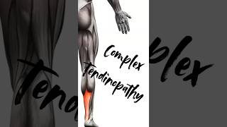 letstalkabout complex tendinopathy sports sportsmedicine sportsdoctor sportsinjury fyp [upl. by Adnawuj]