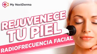 RADIOFRECUENCIA FACIAL ¿Qué es y cuáles son sus beneficios [upl. by Werda]