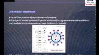 Diagnostic serologique virologique du sida biologie moléculaire [upl. by Heady]