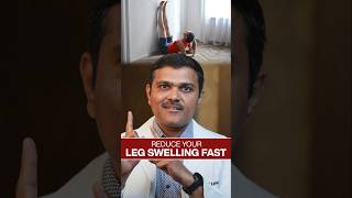 FAST Relief for Swollen Legs in 2024 [upl. by Asaph]