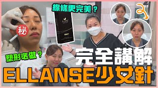 ELLANSE少女針｜ 想做輪廓塑形一定要揀佢？打完後立即消除虎紋，立即提升蘋果肌？痛唔痛？點打？ 真人拍片過程全拆解！ medskinHK [upl. by Wilen]