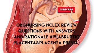 obgnursing nclexreview questions on abruptioplacentaplacentaprevianclexpracticeyoutubevideo [upl. by Nnaul]