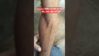 How to give Iv injection stateMediconursingyoutubeshortssorts bollywood song [upl. by Demaria]