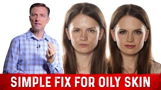 How To Fix Oily Skin With Simple Hack – Dr Berg [upl. by Noedig]