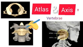 cervical vertebrae anatomy atlas and axis  C1 and C2 vertebrae  odontoid process [upl. by Grevera]