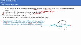 31 A What is the fundamental difference between hypermetropia and myopia in terms of the optical [upl. by Xuagram]