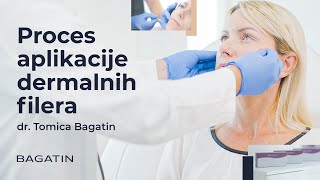 Proces aplikacije dermalnih filera s dr Tomicom Bagatinom  Poliklinika Bagatin [upl. by Anaiad320]