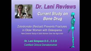 Dr Lani Reviews New Study on Bone Drug [upl. by Eiliak]