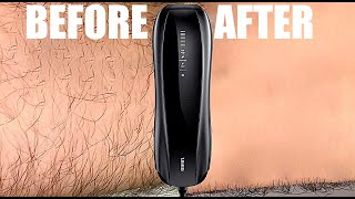 Does IPL Hair Removal Work For MEN Too Ulike X Laser Hair Removal For Men [upl. by Ward252]