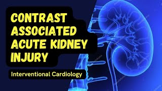 Contrast nephropathy Contrast associated Acute Kidney Injury [upl. by Aitropal]